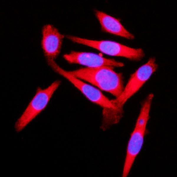  IF analysis of KLC1 using anti-KLC1 antibody (A04116-2)