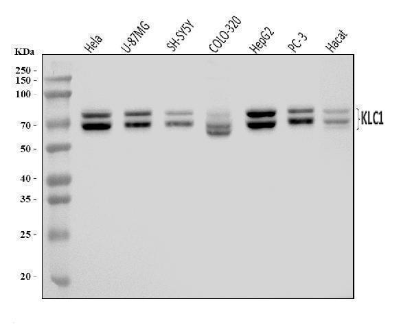  Western blot analysis of KLC1 using anti-KLC1 antibody (A04116-2)