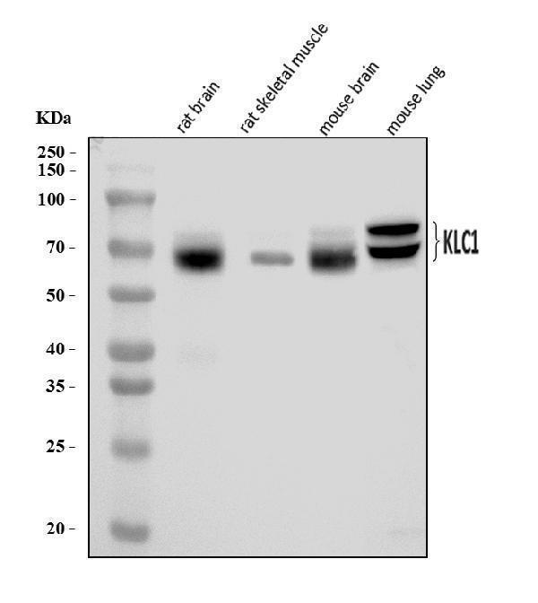 Western blot analysis of KLC1 using anti-KLC1 antibody (A04116-2)