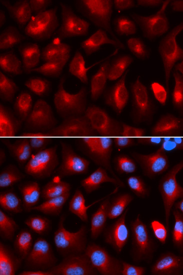 Immunofluorescence analysis of U2OS cells, using KLC1 polyclonal antibody