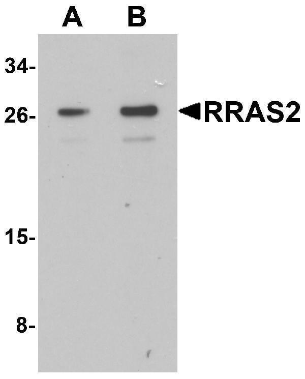Western blot analysis of RRAS2 in Jurkat cell lysate with RRAS2 antibody at (A) 1 and (B) 2 μg/mL
