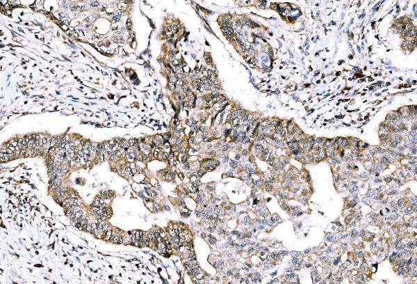  IHC analysis of GRHL2 using anti-GRHL2 antibody (A04120-2)