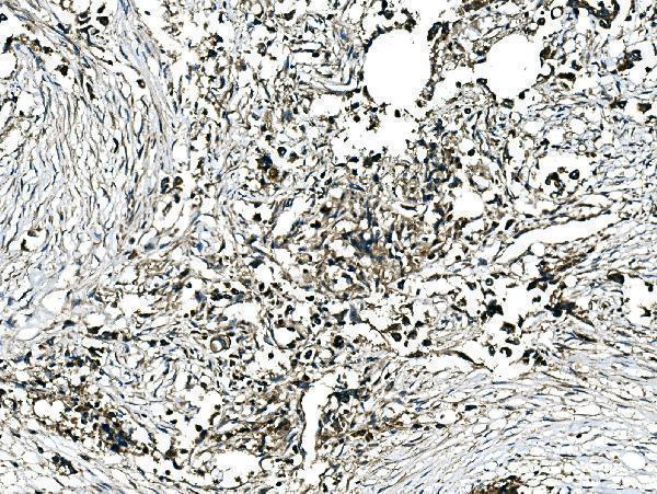  IHC analysis of GRHL2 using anti-GRHL2 antibody (A04120-2)