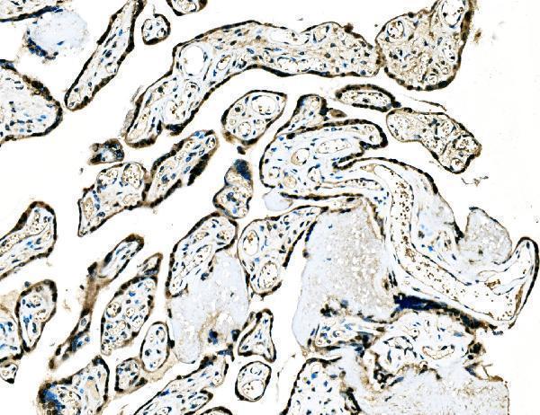 a04120 2 grhl2 primary antibodies ihc testing 4