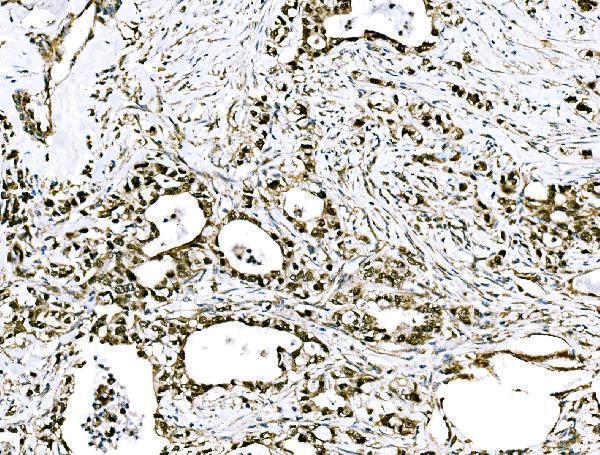 a04120 2 grhl2 primary antibodies ihc testing 5