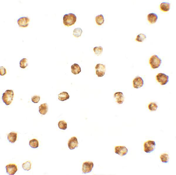 Immunocytochemistry of OASL1 in HepG2 cells with OASL1 antibody at 2