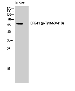 Western blotting validation for Anti-Phospho-4