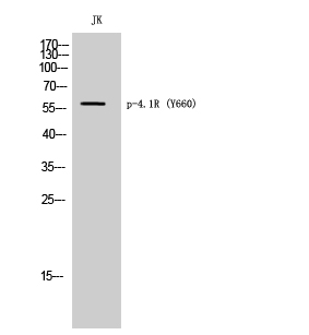Western blotting validation for Anti-Phospho-4