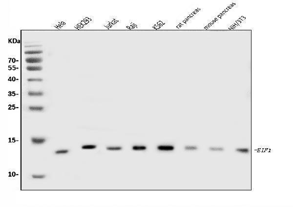  Western blot analysis of EIF1 using anti-EIF1 antibody (A04125-1)