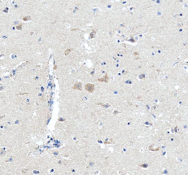 a04126 scn11a primary antibodies ihc testing 4