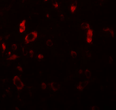 Immunofluorescence of PIAS2 in rat brain tissue with PIAS2 antibody at 20 μg/mL