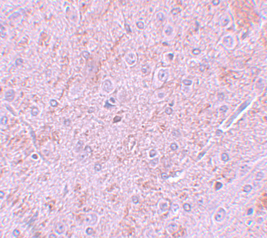 Immunohistochemistry of PIAS2 in rat brain tissue with PIAS2 antibody at 5 μg/mL