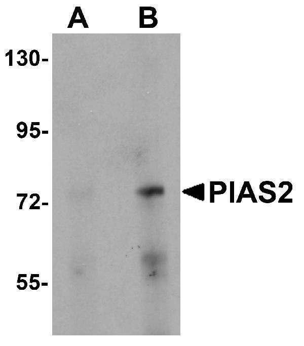 Western blot analysis of PIAS2 in rat brain tissue lysate with PIAS2 antibody at (A) 1 and (B) 2 μg/mL