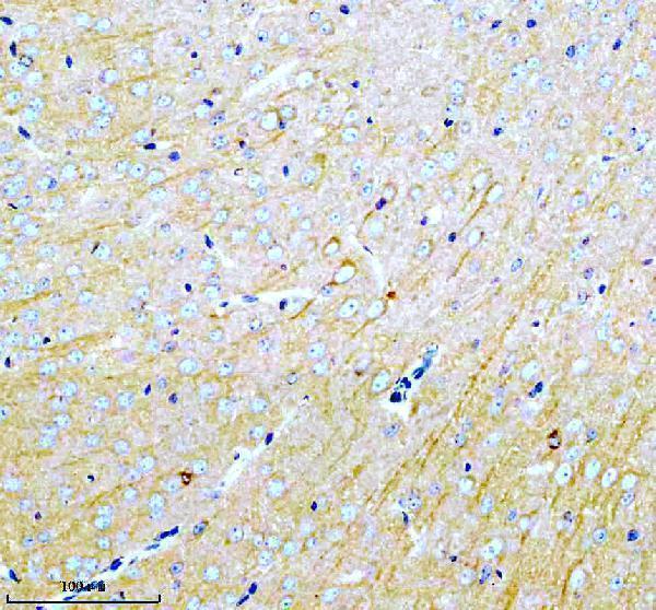  IHC analysis of MARCKS using anti-MARCKS antibody (A04133-4)