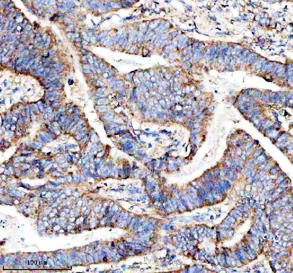 a04133 4 marcks primary antibodies ihc testing 4