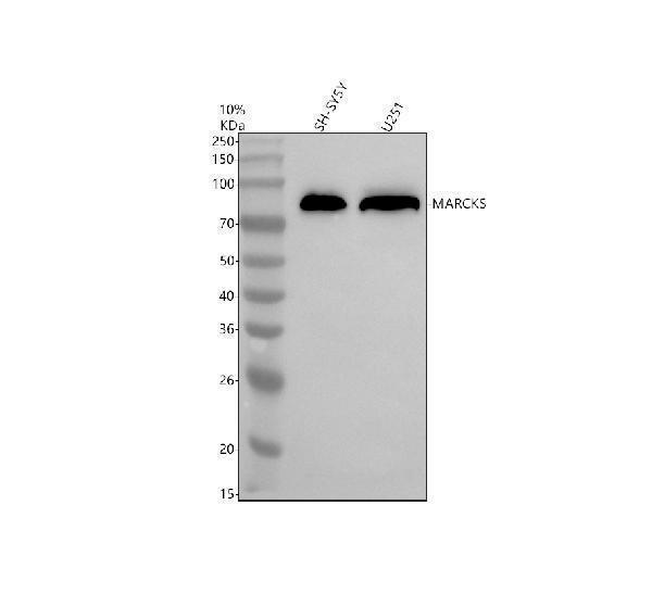  Western blot analysis of MARCKS using anti-MARCKS antibody (A04133-4)