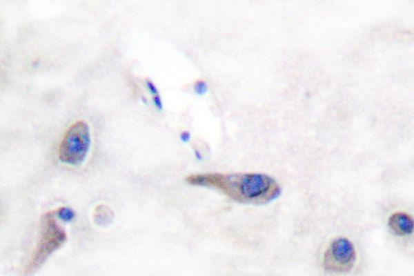 Immunohistochemistry (IHC)analyzes of MARCKS (R157) pAb in paraffin-embedded human brain tissue