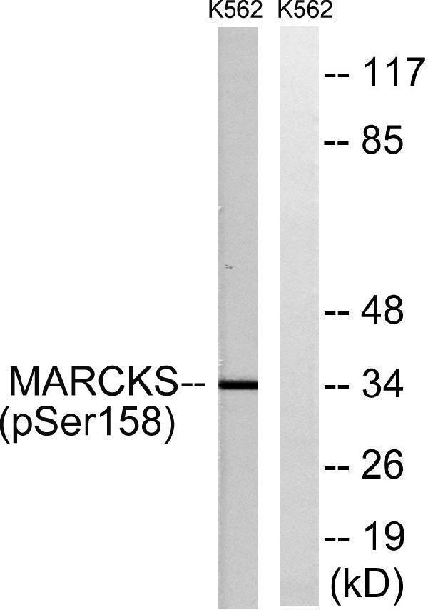 Western blot analysis of lysates from K562 cells treated with EGF 200ng/ml 30', using MARCKS (Phospho-Ser158) Antibody