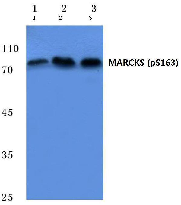 a04133s163 marcks primary antiboties wb testing 1