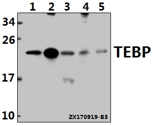 Western blot (WB) analysis of TEBP (K107) pAb at 1:500 dilution
Lane1:SK-OVCAR3 whole cell lysate(40ug)
Lane2:HEK293T whole cell lysate(40ug)
Lane3:Hela whole cell lysate(40ug)
Lane4:3T3-L1 whole cell lysate(40ug)
Lane5:C6 whole cell lysate(40ug)