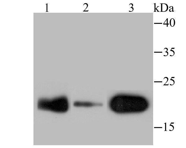 Western blot analysis of p23 on different lysates using anti-p23 antibody at 1/500 dilution