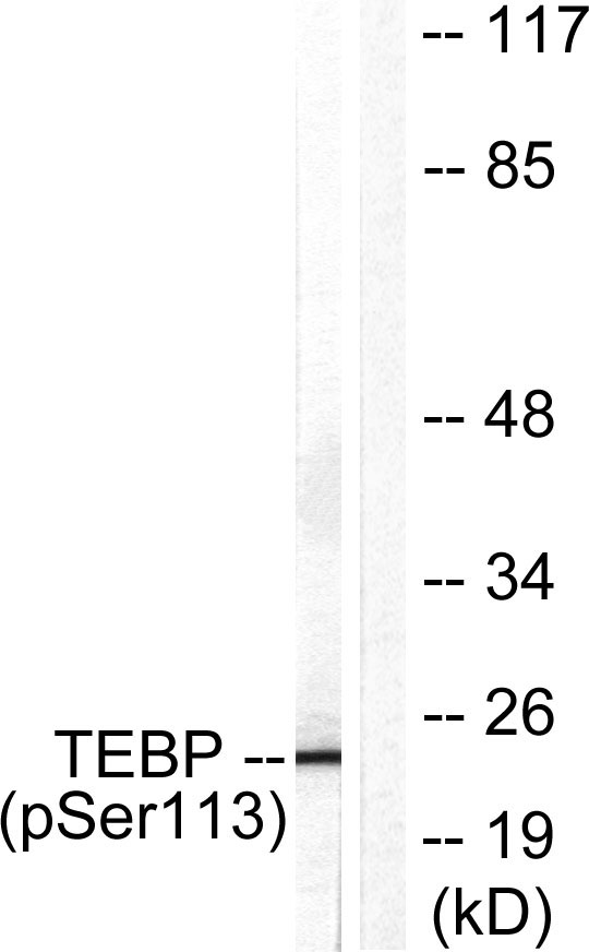 Western blot analysis of lysates from NIH/3T3 cells treated with EGF 200ng/ml 30