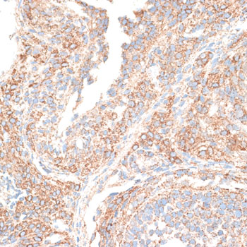 a04137 kif14 primary antiboties ihc testing 2