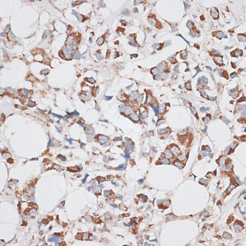 a04137 kif14 primary antiboties ihc testing 3