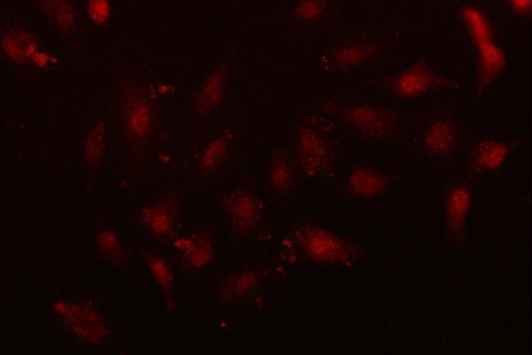 a04138 1 nfix primary antibodies if testing 2