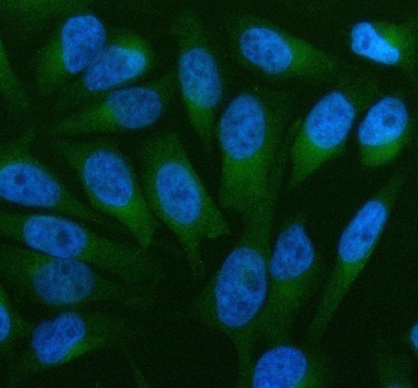 a04143 1 tom1 primary antibodies if testing 4