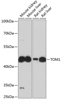 a04143 tom1 primary antiboties wb testing 1