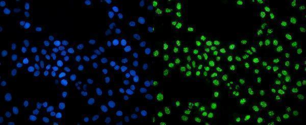 a04146 1 exosc3 primary antibodies if testing 6