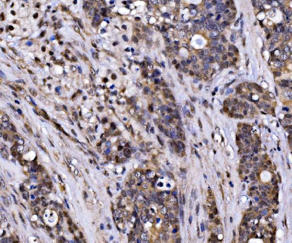  IHC analysis of EXOSC3 using anti-EXOSC3 antibody (A04146-1)