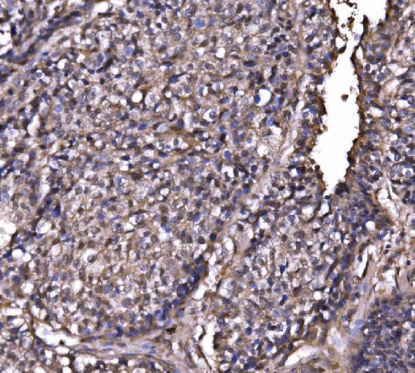 a04146 1 exosc3 primary antibodies ihc testing 3