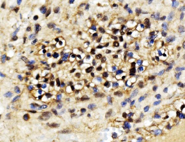 a04146 1 exosc3 primary antibodies ihc testing 4