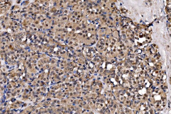 a04146 1 exosc3 primary antibodies ihc testing 5