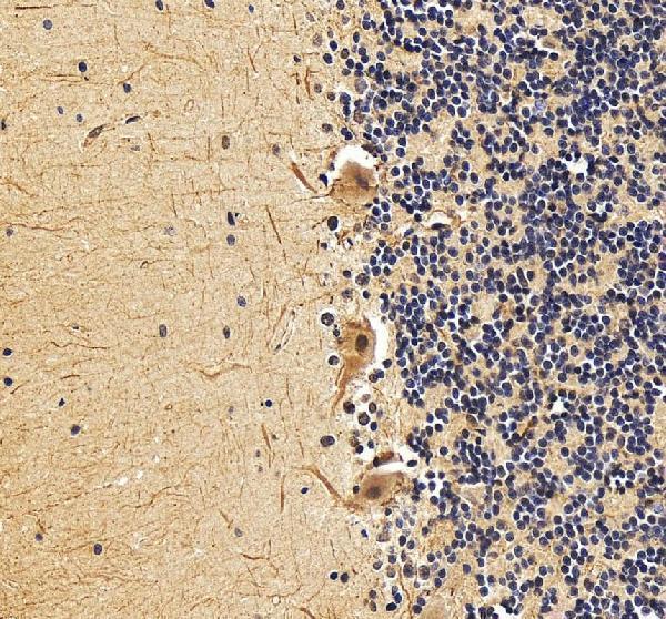 IHC analysis of EXOSC3 using anti-EXOSC3 antibody (A04146-1)