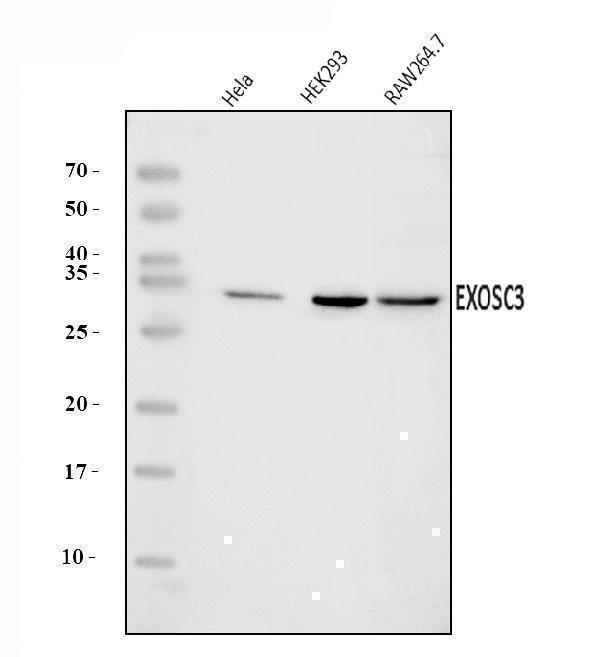  Western blot analysis of EXOSC3 using anti-EXOSC3 antibody (A04146-1)