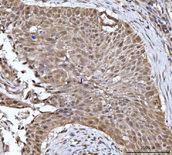  IHC analysis of 14-3-3 gamma/YWHAG using anti-14-3-3 gamma/YWHAG antibody (A04148-2)