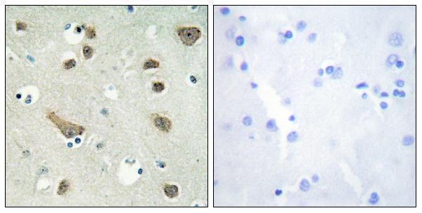 Immunohistochemistry analysis of paraffin-embedded human brain tissue, using 14-3-3 gamma Antibody