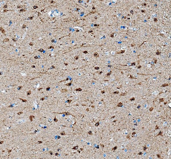 IHC analysis of SAP102/DLG3 using anti-SAP102/DLG3 antibody (A04152-1)