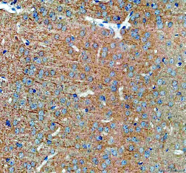IHC analysis of SAP102/DLG3 using anti-SAP102/DLG3 antibody (A04152-1)