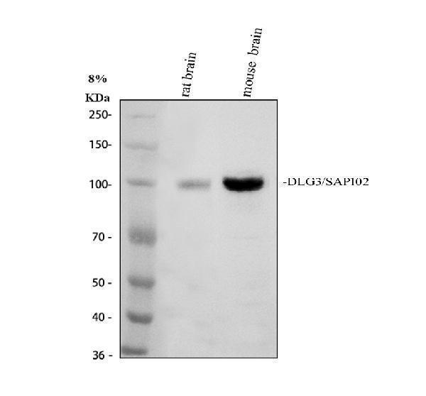 Western blot analysis of DLG3 using anti-DLG3 antibody (A04152-1)