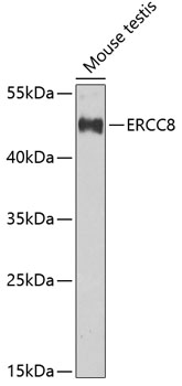 Western blot analysis of extracts of mouse testis, using ERCC8 Antibody  at 1:1000 dilution