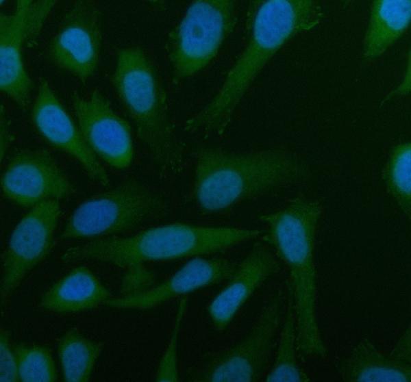 a04155 1 arl2 primary antibodies if testing 3