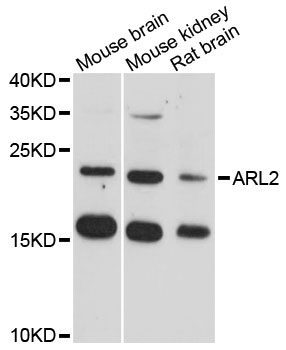 Western blot analysis of extracts of various cell lines, using ARL2 antibody at 1:3000 dilution