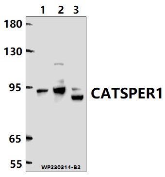 Western blot (WB) analysis of CATSPER1 polyclonal antibody at 1:1000 dilution
Lane1:A549 whole cell lysate
Lane2:Hela whole cell lysate 
Lane3:SP2/0 whole cell lysate 