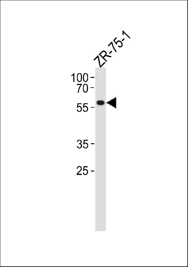 PPP2R2A Antibody (N-term) (Cat. #A04159) western blot analysis in ZR-75-1 cell line lysates (35ug/lane). This demonstrates the PPP2R2A antibody detected the PPP2R2A protein (arrow).