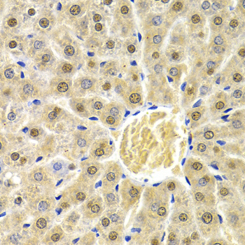 a04161 rad9a primary antiboties ihc testing 2