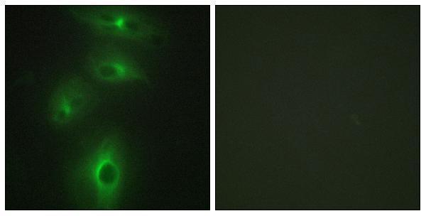a04164 1 tmprss3 primary antibodies if testing 1